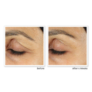 RETINOL CORREXION® Eye Cream