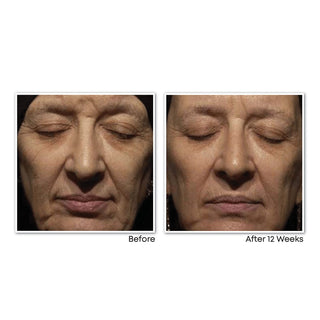 RETINOL CORREXION® Deep Wrinkle Night Cream