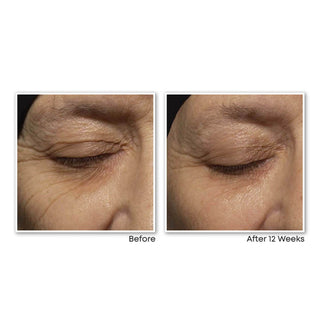 RETINOL CORREXION® Deep Wrinkle Night Cream