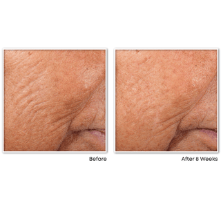 RETINOL CORREXION® Line Smoothing Night Serum Capsules