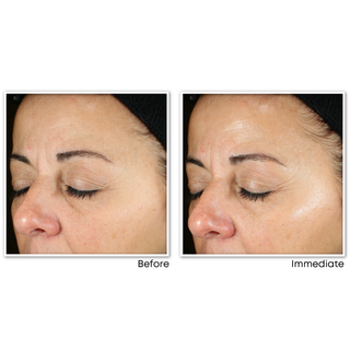 multi correxion® revive + glow daily serum