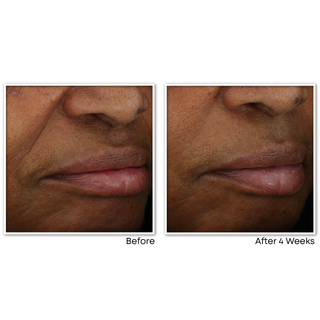 multi correxion® revive + glow gel cream