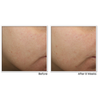 multi correxion® revive + glow gel cream